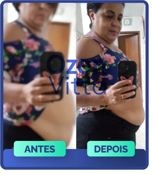 Antes e Depois 5